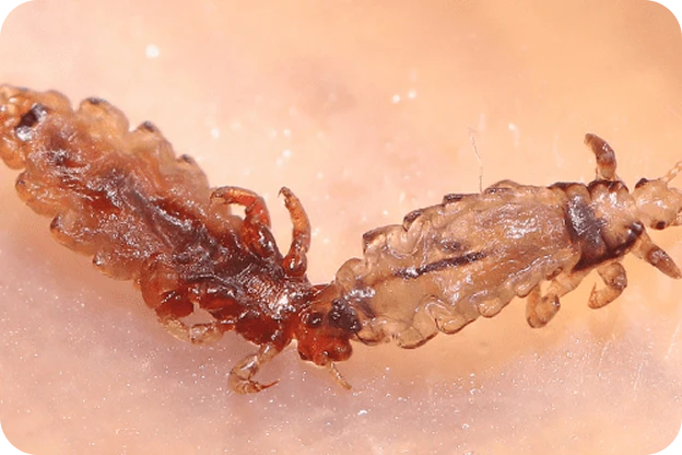A close-up of head lice on skin